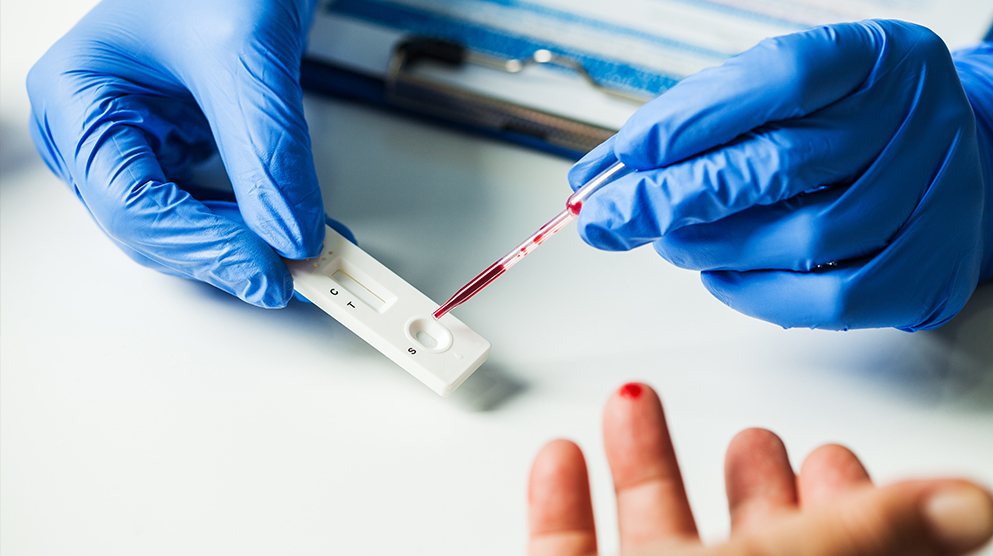 Antigen rapid test for the detection of SARS CoV-2 and Influenza